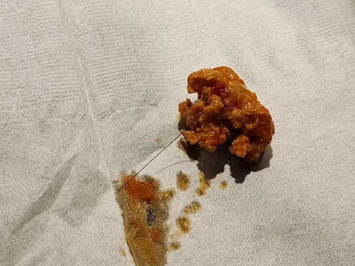 김치찌개 속 머리카락